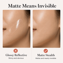 LIFTÉRA™ Invisible V-Lift Patches