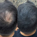 LANLSLO 2.0 – Instant Hair Concealment, Sweat-Resistant & Safe for Daily Use