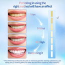 Niacinamide Intensive Whitening Toothpaste - Stain Removal & Fresh Breath