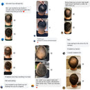 LANLSLO 2.0 – Instant Hair Concealment, Sweat-Resistant & Safe for Daily Use