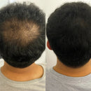 LANLSLO 2.0 – Instant Hair Concealment, Sweat-Resistant & Safe for Daily Use