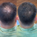 LANLSLO 2.0 – Instant Hair Concealment, Sweat-Resistant & Safe for Daily Use