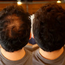 LANLSLO 2.0 – Instant Hair Concealment, Sweat-Resistant & Safe for Daily Use