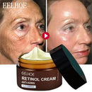 Retinol Wrinkle Remover Face Cream Firming Lifting Anti Aging Fade Fine Lines Moisturizing Whitening Skin Care Korean Cosmetics