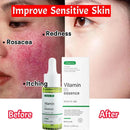 Facial Redness Repair Serum Improve Sensitive Skin Dryness Moisturizer Hydrating Sooth Lotion Removal Rosacea Korean Cosmetics
