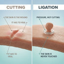 DERMORA™ Skin Tag Remover